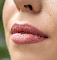 Lip filler 1