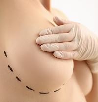 breast filler