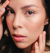 cheek filler 1