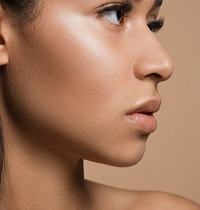 chin filler 1